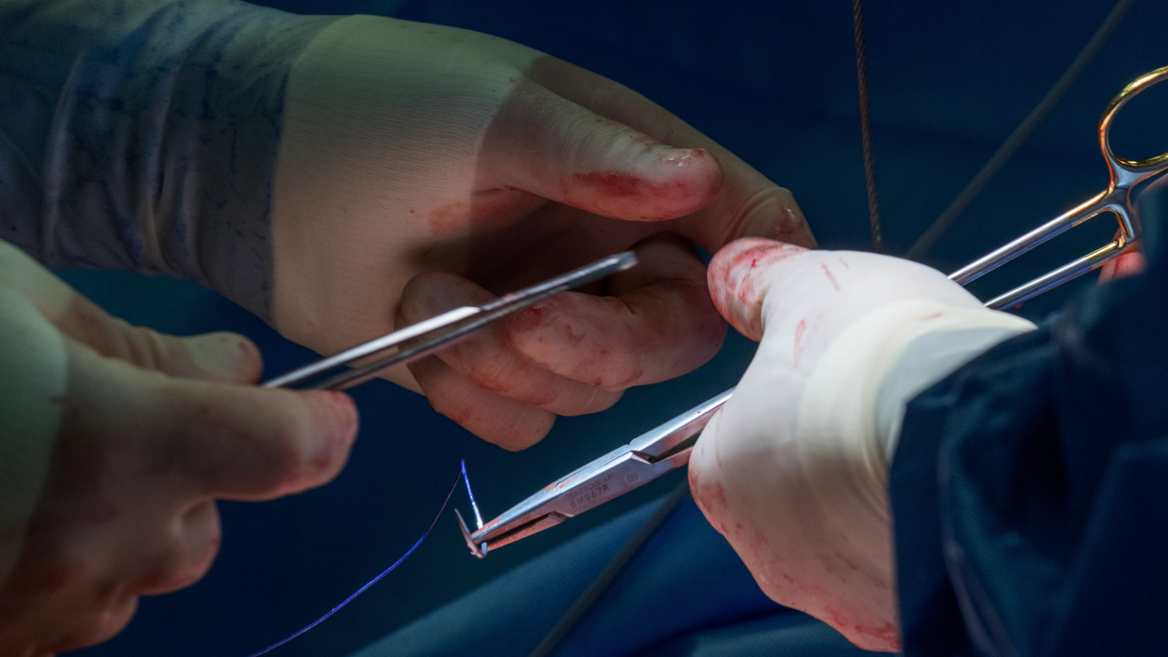 Beautiful heart surgery photograph