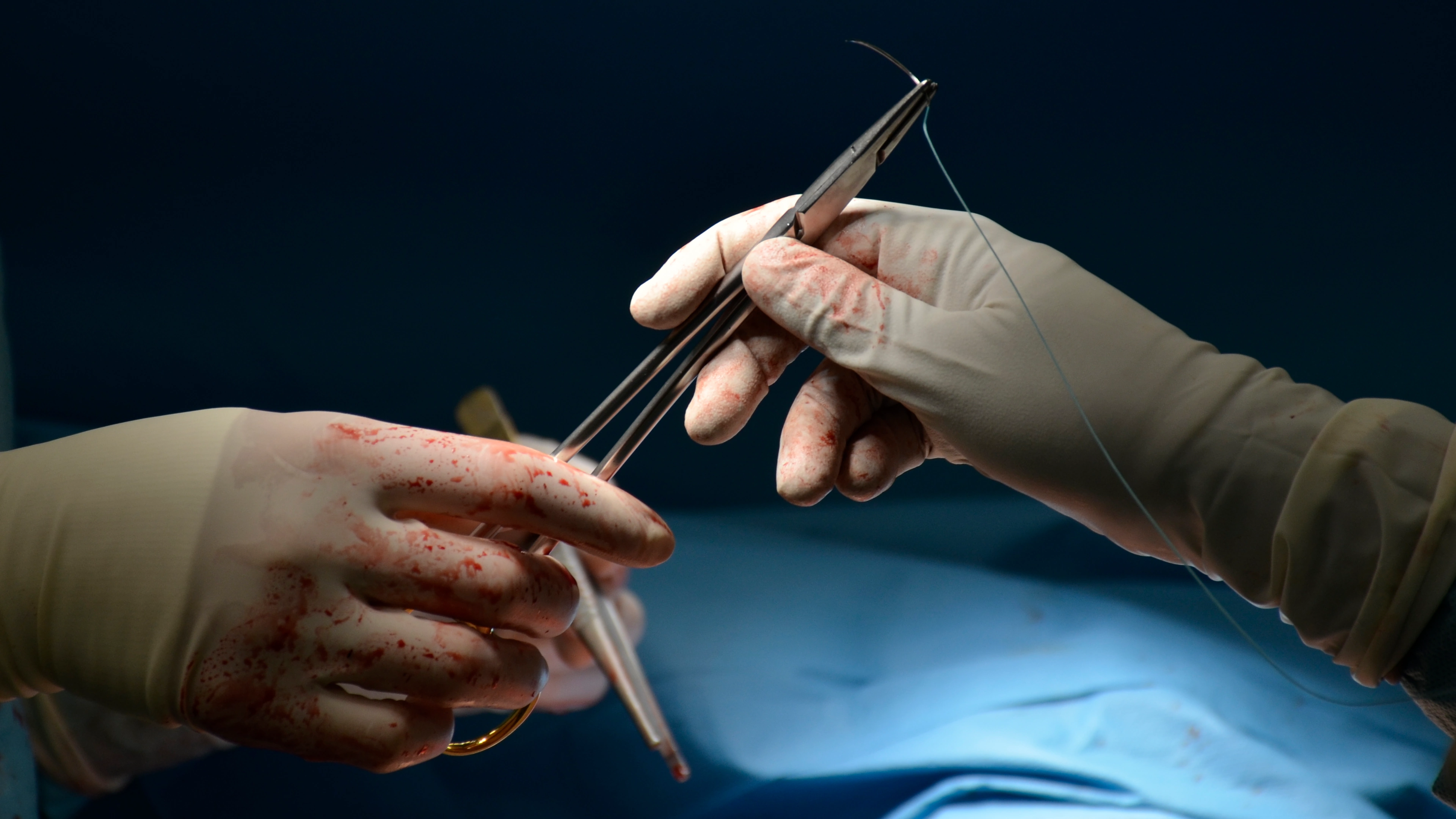 Beautiful heart surgery photograph